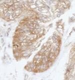 eIF3B/EIF3S9 Antibody in Immunohistochemistry (IHC)