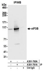 eIF3B/EIF3S9 Antibody in Western Blot (WB)