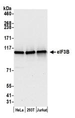 eIF3B/EIF3S9 Antibody in Western Blot (WB)