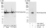eIF3B/EIF3S9 Antibody in Western Blot (WB)
