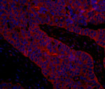 eIF3B/EIF3S9 Antibody in Immunohistochemistry (IHC)