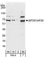 eIF3D/EIF3S7 Antibody in Western Blot (WB)