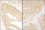 eIF3J/EIF3S1 Antibody in Immunohistochemistry (IHC)