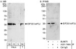 eIF3J/EIF3S1 Antibody in Western Blot (WB)