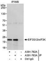 eIF3K/EIF3S12 Antibody in Immunoprecipitation (IP)