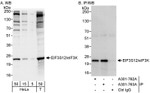 eIF3K/EIF3S12 Antibody in Western Blot (WB)