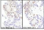 eIF4AIII/EIF4A3 Antibody in Immunohistochemistry (IHC)