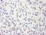 eIF4AIII/EIF4A3 Antibody in Immunohistochemistry (IHC)