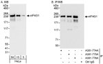 eIF4G1/eIF4GI Antibody in Western Blot (WB)