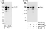 eIF4G1/eIF4GI Antibody in Western Blot (WB)