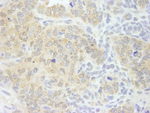 eIF4G1/eIF4GI Antibody in Immunohistochemistry (IHC)