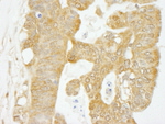 eIF4G1/eIF4GI Antibody in Immunohistochemistry (IHC)