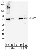 eIF5 Antibody in Western Blot (WB)