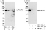 eIF5B/IF2 Antibody in Western Blot (WB)