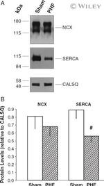 Sodium/Calcium Exchanger Antibody in Western Blot (WB)