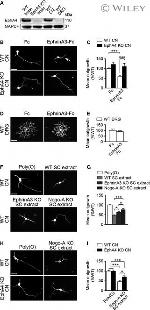 EphA4 Antibody in Western Blot (WB)