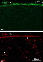 Connexin 26 Antibody in Immunohistochemistry (IHC)