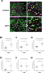 AKT1 Antibody in Immunohistochemistry (IHC)