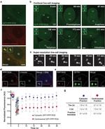 mCherry Antibody in Immunocytochemistry (ICC/IF)