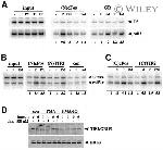 SRC2 Antibody in Western Blot, ChIP Assay (WB, ChIP)