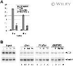 SRC2 Antibody in ChIP Assay (ChIP)