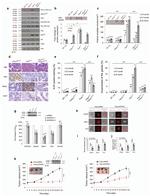 PDHA1 Antibody in Western Blot (WB)