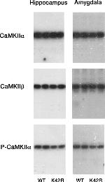 CaMKII beta Antibody in Western Blot (WB)