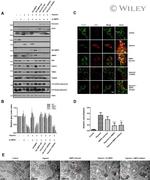 AMPK alpha-1 Antibody in Western Blot (WB)