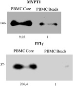 PP1 gamma Antibody in Western Blot (WB)