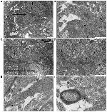 NG2 Antibody in Immunohistochemistry, Immunomicroscopy (IHC, IM)