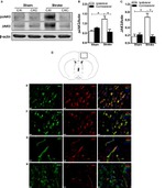 JAK3 Antibody in Western Blot, Immunocytochemistry (WB, ICC/IF)