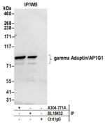 gamma Adaptin/AP1G1 Antibody in Western Blot (WB)