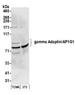 gamma Adaptin/AP1G1 Antibody in Western Blot (WB)