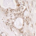 Phospho-gamma-H2AX (Ser139) Antibody in Immunohistochemistry (IHC)