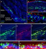 CD271 (NGF Receptor) Antibody in Immunohistochemistry (IHC)