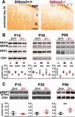 N-cadherin Antibody in Western Blot (WB)