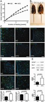 Vimentin Antibody in Immunohistochemistry (IHC)