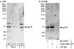 gp78 Antibody in Western Blot (WB)