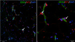 AGTR1 Antibody in Immunohistochemistry (IHC)