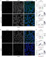 CD20 Antibody in Immunohistochemistry (IHC)