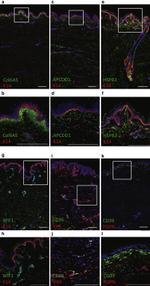 CD36 Antibody in Immunohistochemistry (IHC)