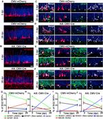 mCherry Antibody in Immunohistochemistry (IHC)