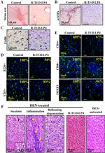 CD3e Antibody in Immunohistochemistry (IHC)