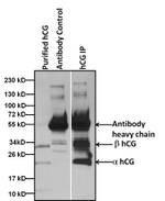 hCG Antibody in Immunoprecipitation (IP)