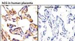 hCG Antibody in Immunohistochemistry (Paraffin) (IHC (P))