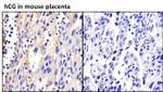 hCG Antibody in Immunohistochemistry (Paraffin) (IHC (P))