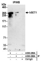 hSET1 Antibody in Western Blot (WB)