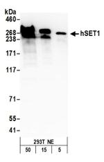 hSET1 Antibody in Western Blot (WB)