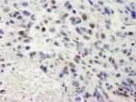 hSET1 Antibody in Immunohistochemistry (IHC)