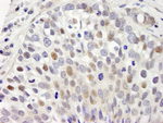 hSET1 Antibody in Immunohistochemistry (IHC)